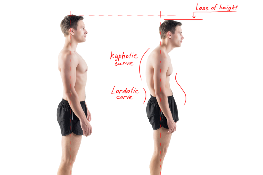 Posture and Pain